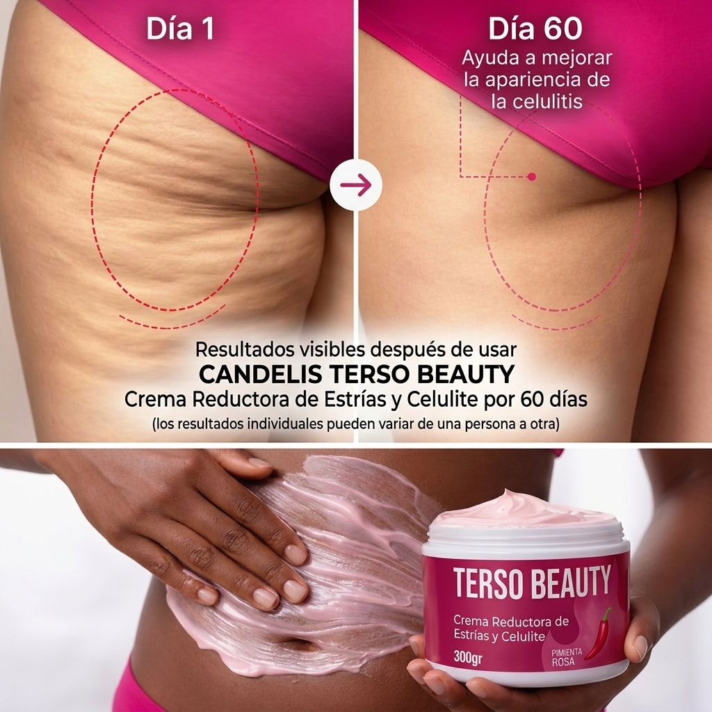 Crema Reductora de Estrías y Celulitis Terso Beauty