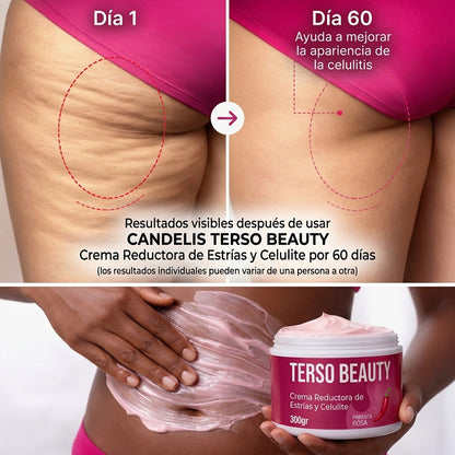 Crema Reductora de Estrías y Celulitis Terso Beauty